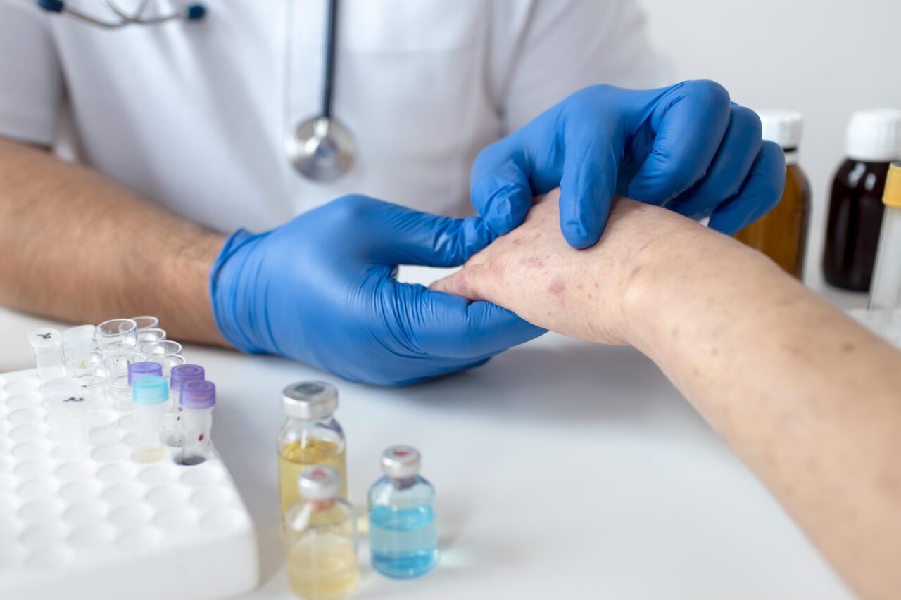 3 enfermedades raras de la piel 2 enfermedades de la piel