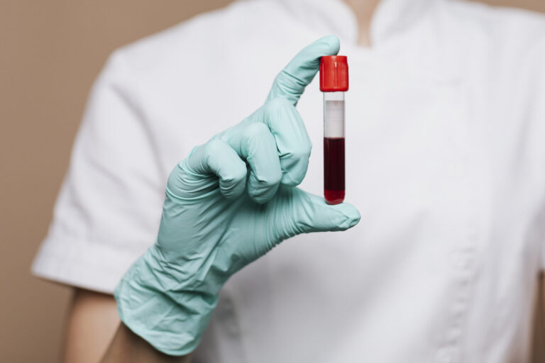 anemia ferropénica