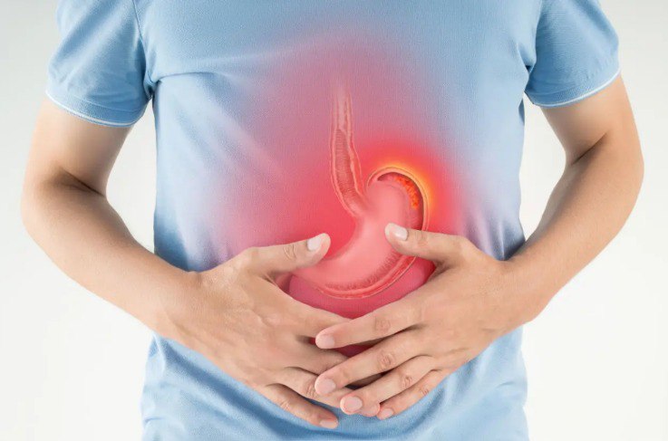 Reflujo gástrico y acidez estomacal ¿Cómo combatirlos? 1 reflujoyacidez-grupofarmadelecuador