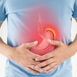 reflujoyacidez
